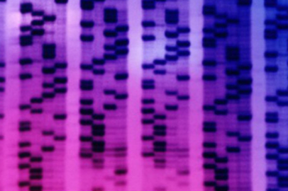 Prostat kanserinde erken teşhis için tükürük testi!